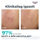 EUCERIN DermoPure Clinical Peeling 10 Bőrmegújító szérum 40 ml
