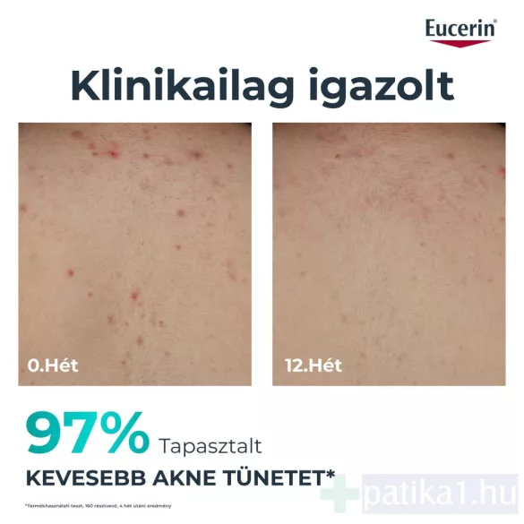Eucerin DermoPure Clinical Correcting Body Care Testkrém 200 ml